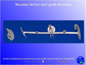Guide de coupes pour greffe fibula  p ron    positdental 031 v5orzc - Eugenol
