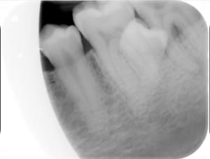 Hd150827111914 vfj95o - Eugenol