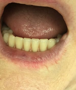 Img 0289 og266w - Eugenol