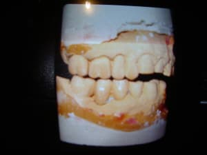 Imgp0198 hn6t1f - Eugenol