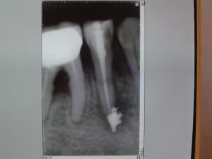 Imgp0525 jvucfx - Eugenol