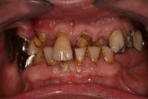 Img 0006 dd5ogx - Eugenol