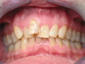 Img 0023 whjkiu - Eugenol