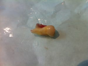 Img 0127 kctp52 - Eugenol