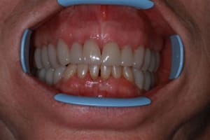 Img 0188 drnwtr - Eugenol