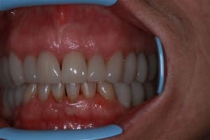 Img 0191 uwudea - Eugenol