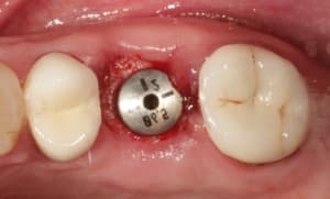 Img 0232 xefsil - Eugenol