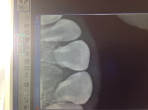 Img 0262 1  skwygx - Eugenol