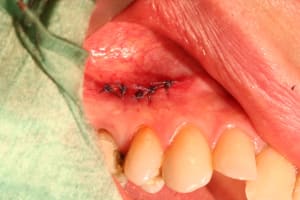 Img 0269 z0sluh - Eugenol