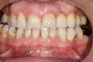 Img 0273 ulsbee - Eugenol