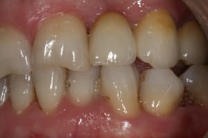 Img 0274 drhdmm - Eugenol