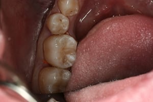 Img 0279 mbfgvi - Eugenol