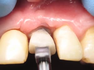 Img 0301 qxf4cr - Eugenol