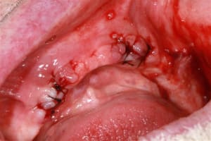 Img 0315 rvlua1 - Eugenol