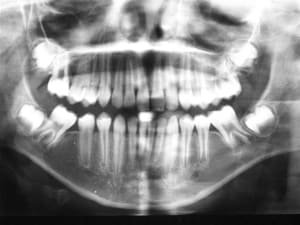 Img 0395  small  fzztte - Eugenol