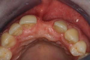 Img 0425 abi9gu - Eugenol