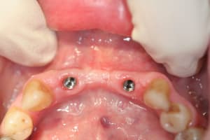 Img 0511 srf9uo - Eugenol