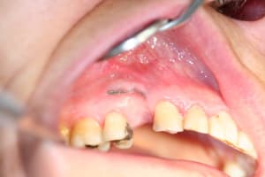 Img 0539 m1ksyu - Eugenol