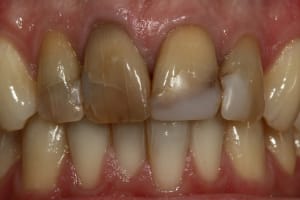 Img 0714 ed8mcp - Eugenol