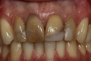 Img 0716 i8ymbv - Eugenol