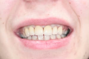 Img 0815 qte9rv - Eugenol