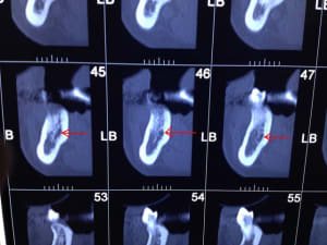Img 0901 a5z5yi - Eugenol