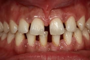 Img 0912 shdlt2 - Eugenol