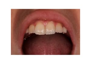 Img 1125 2 rygae5 - Eugenol