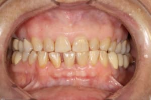 Img 1197 icdslb - Eugenol