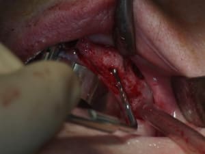 Img 1226 yfwyin - Eugenol