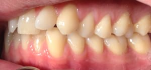 Img 1235 ynminp - Eugenol