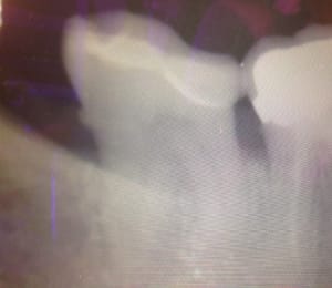 Img 1323 vraw5k - Eugenol