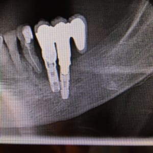 Img 1380 st93w9 - Eugenol