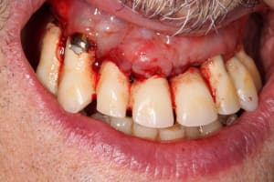 Img 1453 mwve8p - Eugenol