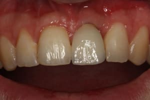 Img 1544 ekgelv - Eugenol