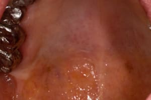 Img 1668 p8xhu1 - Eugenol