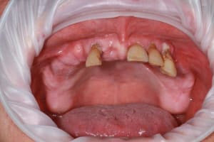 Img 1670 ie4unw - Eugenol