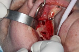 Img 1784 bfmtpv - Eugenol