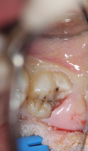 Img 1796 zzvd1n - Eugenol