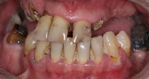 Img 1799 xhkibn - Eugenol