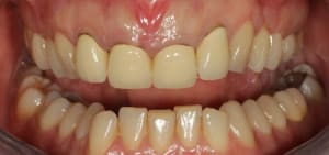 Img 1817 er9wmj - Eugenol