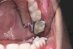 Img 1870 novbbx - Eugenol