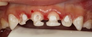 Img 1885 hruzk6 - Eugenol