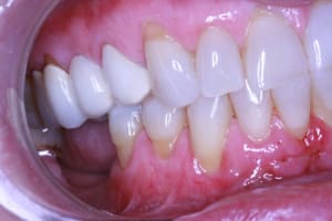 Img 1995 cd7un0 - Eugenol