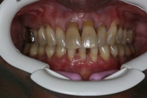 Img 1 axr9xs - Eugenol