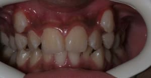 Img 1 bgeubs - Eugenol