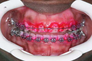 Img 1 xcgimr - Eugenol