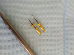 Img 20190909 172914 eto3n6 - Eugenol