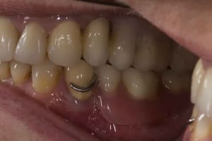 Img 2090 h9gsnt - Eugenol