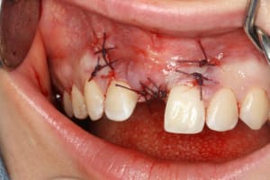 Img 2091 actjus - Eugenol